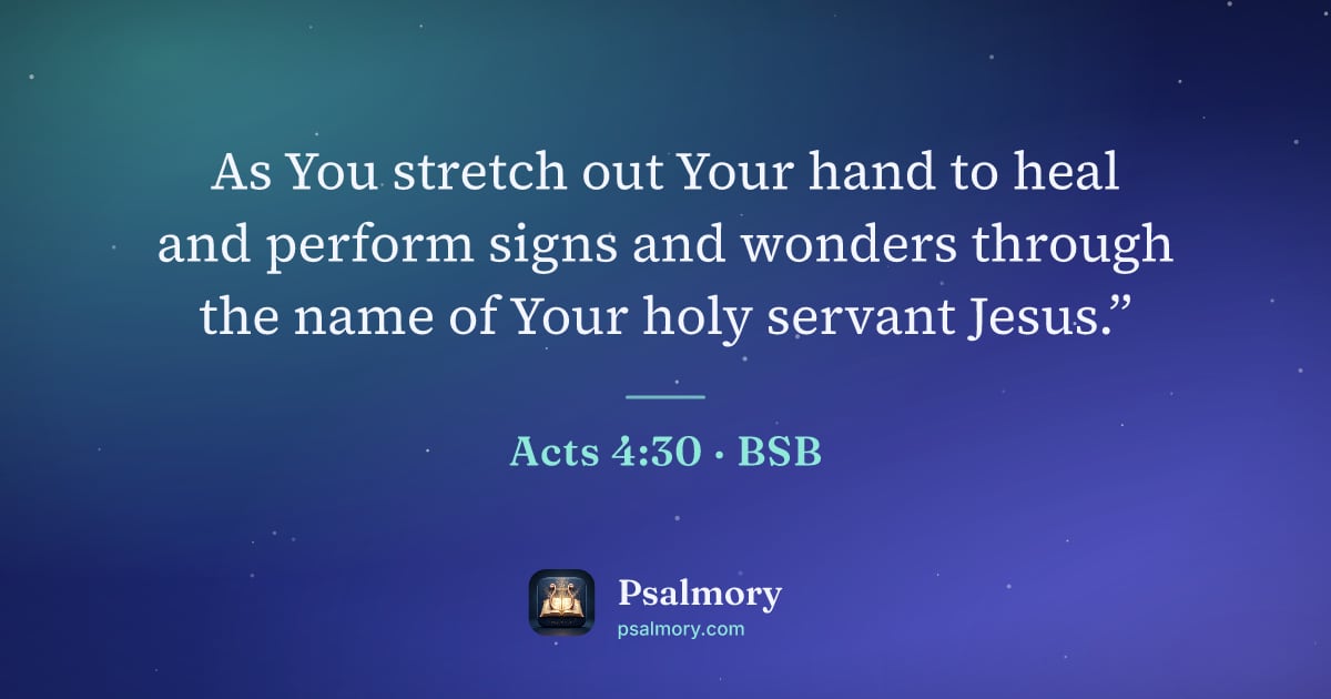 Acts 4:30 verse artwork: As You stretch out Your hand to heal and perform signs and wonders through the name of…